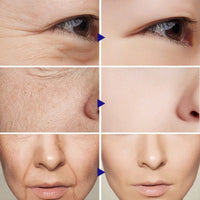 Vitamin C Serum Facial Serum - ElectronicEssence